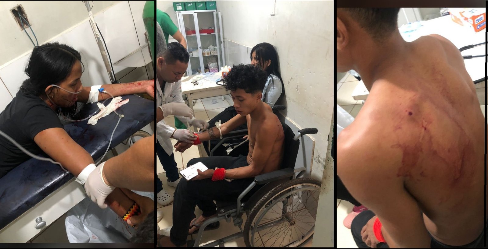 Indígenas Tembé são baleados, em Tomé-Açu, no Pará